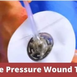 Application of wound vac cpt code