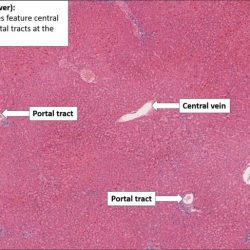 Physiology liver hepatic hepatocytes lobule plates system structural 6th berne levy ed metabolic doctorlib info